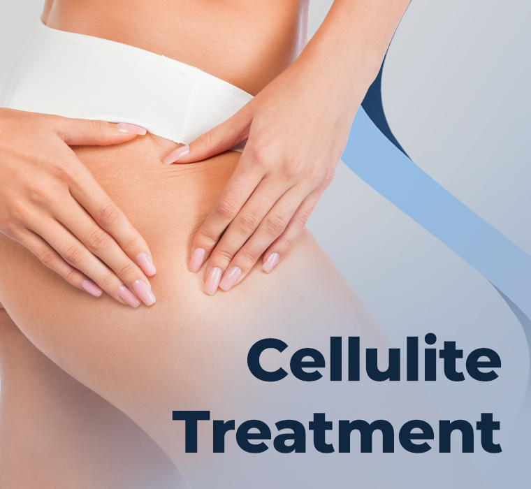 Cellulite Treatment